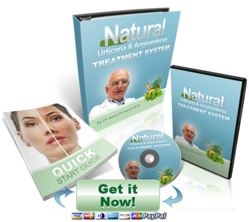 Full Urticaria Cure – Say Goodbye to Hives Naturally!