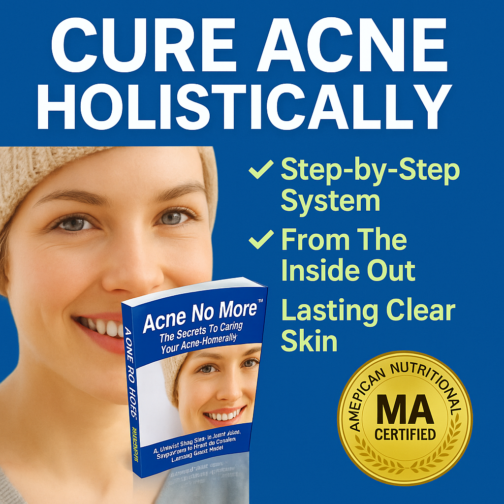 Clear Your Skin Naturally in Just 7 Days with Acné No Más™!