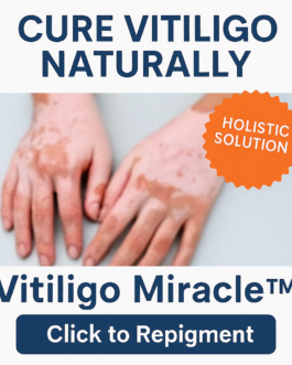 Cure Vitiligo Naturally – Restore Skin Color Without Steroids!