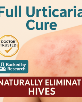 Eliminate Chronic Hives Naturally with This Proven Urticaria Cure!