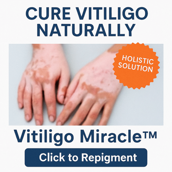 Cure Vitiligo Naturally – Restore Skin Color Without Steroids!
